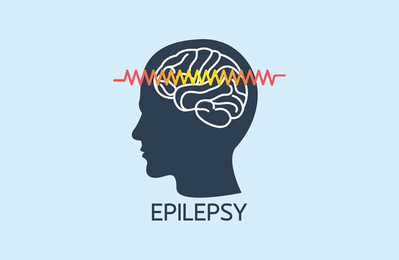 Epilepsy presents painful challenge for youngsters