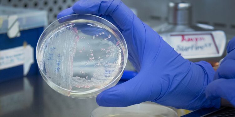 A person with a blue gloved hand holds a petri dish in a lab space. Researchers in Mariette Barbier’s lab at West Virginia University study pathogens such as Pseudomonas aeruginosa, shown here, to better understand bacteria and develop ways to kill it. Barbier is leading a team testing antibodies to treat drug-resistant bacteria. (WVU Photo/Aira Burkhart)